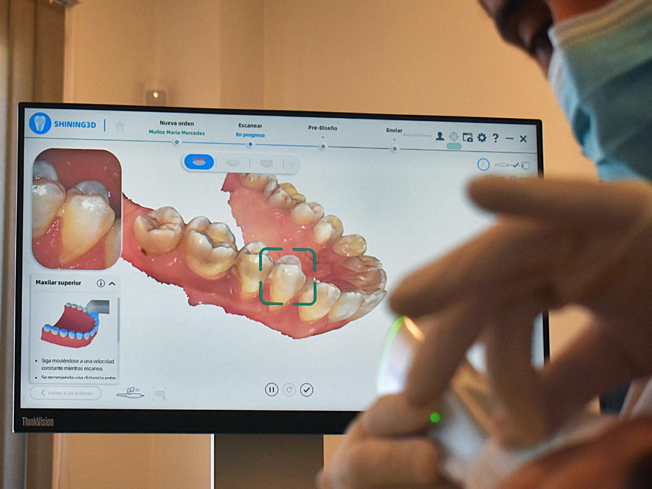 Odontología Digital y Guiada
